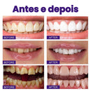 Clareador Dental iziSmile - Dentes Brancos Em Segundos [Desconto + Entrega Gratis Hoje]