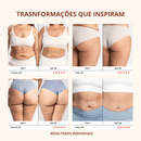 Drena Roller – Massageador Linfático para Lipedema e Celulite