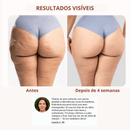 Drena Roller – Massageador Linfático para Lipedema e Celulite