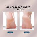 Lixa Elétrica para os Pés Calos Care - Loja Marviva